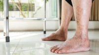 Waspadai! 7 Gejala Diabetes di Pagi Hari yang Sering Diabaikan