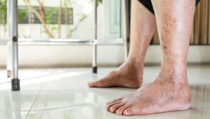 Waspadai! 7 Gejala Diabetes di Pagi Hari yang Sering Diabaikan